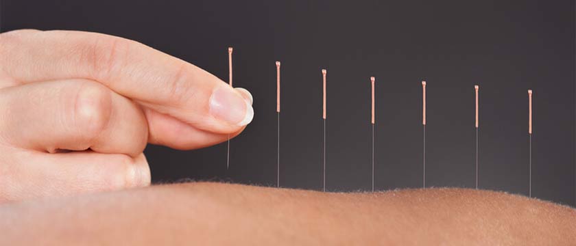 chatswood does acupuncture hurt