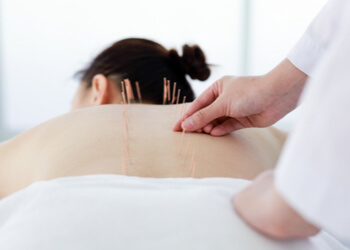 acupuncture treatment procedure chatswood